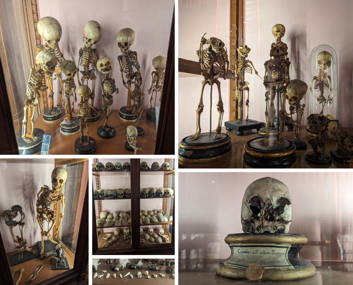 Skulls, bones, skeletons and teeth
