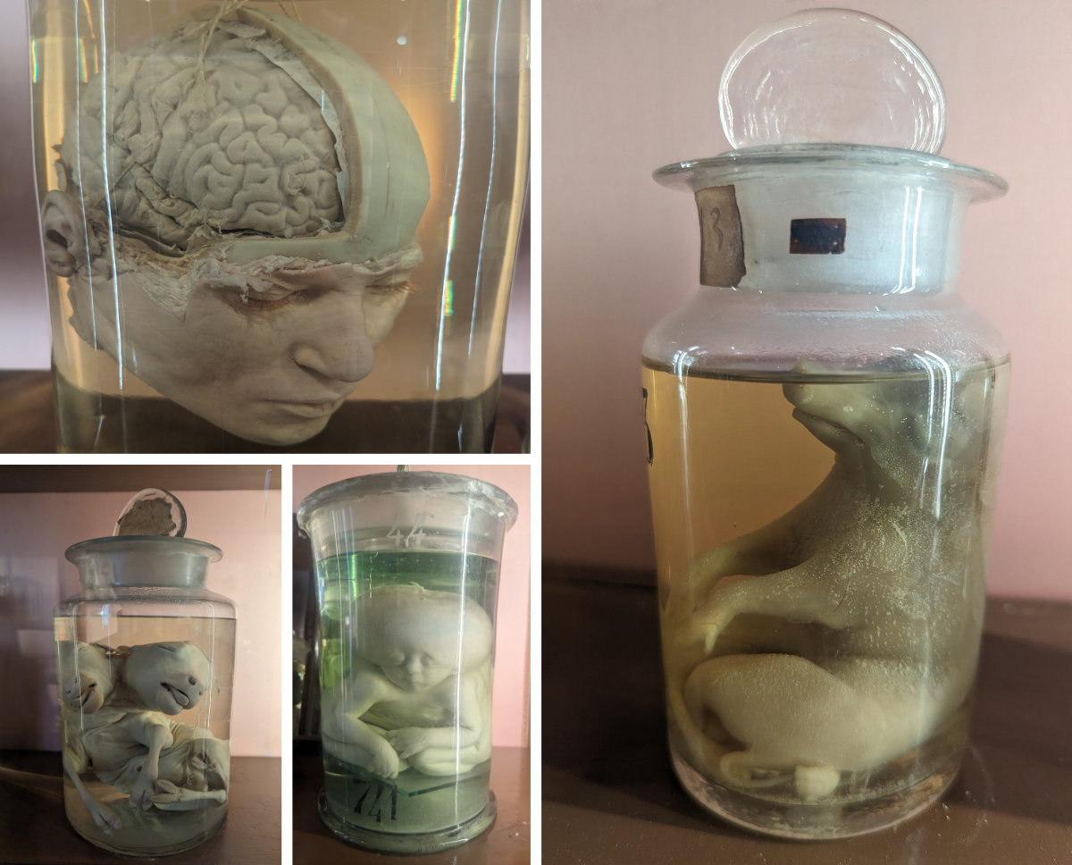 Preservations in jars